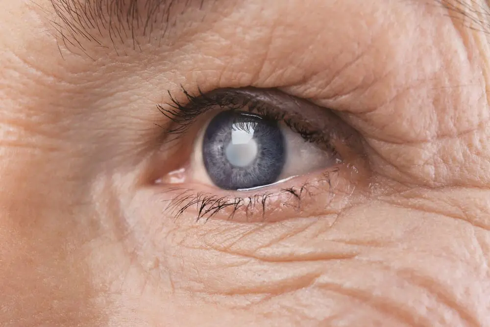 Close-up of an adult human eye with visible wrinkles and skin texture, captured by Eye Care Clinic experts in Idaho and Utah.
